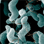 photomicrograph of campylobacter jejuni link to PDF 185KB